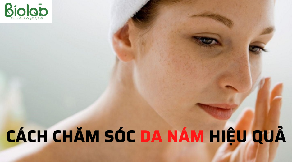 Chăm sóc da nám hiệu quả không phải ai cũng biết