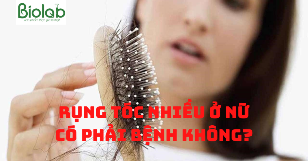 Rụng tóc nhiều ở nữ có phải bệnh không