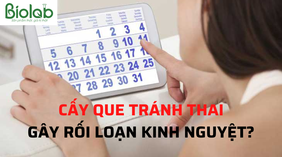 Cấy que tránh thai gây rối loạn kinh nguyệt